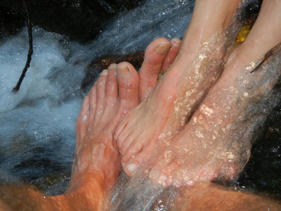 Micosis de las uñas de las piernas